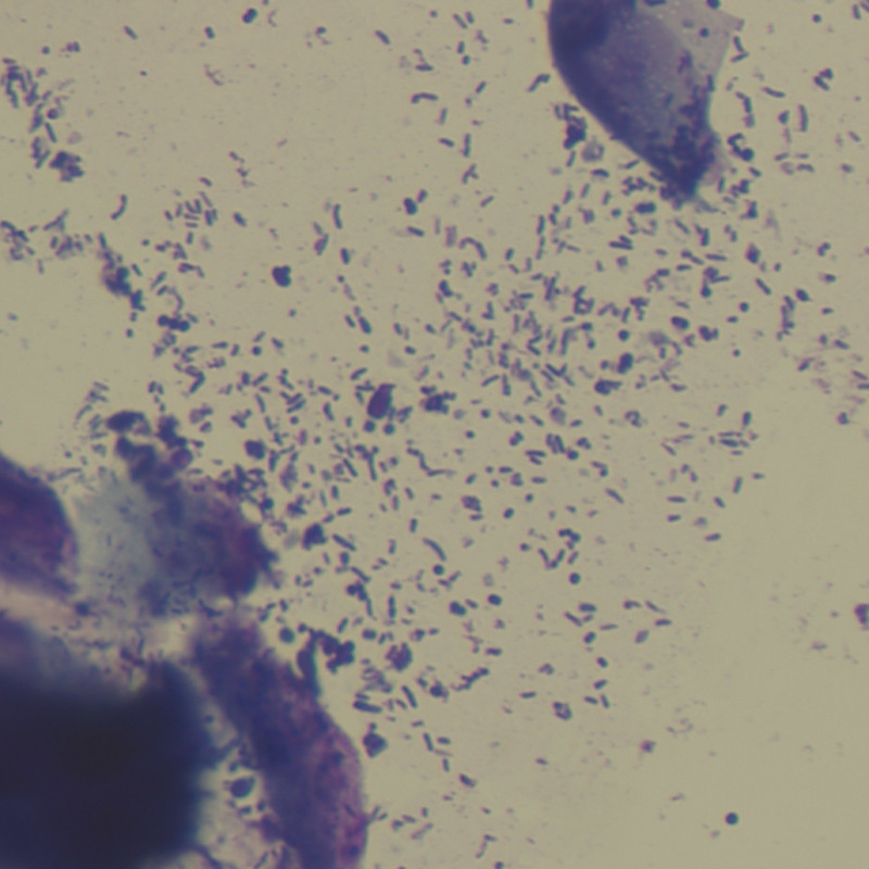 Cockocyte James Oldeschulte